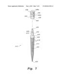 Dental implant system diagram and image