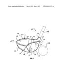 GOLF CLUB HEAD OR OTHER BALL STRIKING DEVICE HAVING ADJUSTABLE STIFFENED FACE PORTION diagram and image