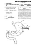 Gastrostomy-jejunostomy tube apparatus and method for endoscopically placing same within a patient diagram and image