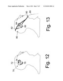 METHODS AND DEVICES FOR MEASURING CORE BODY TEMPERATURE diagram and image