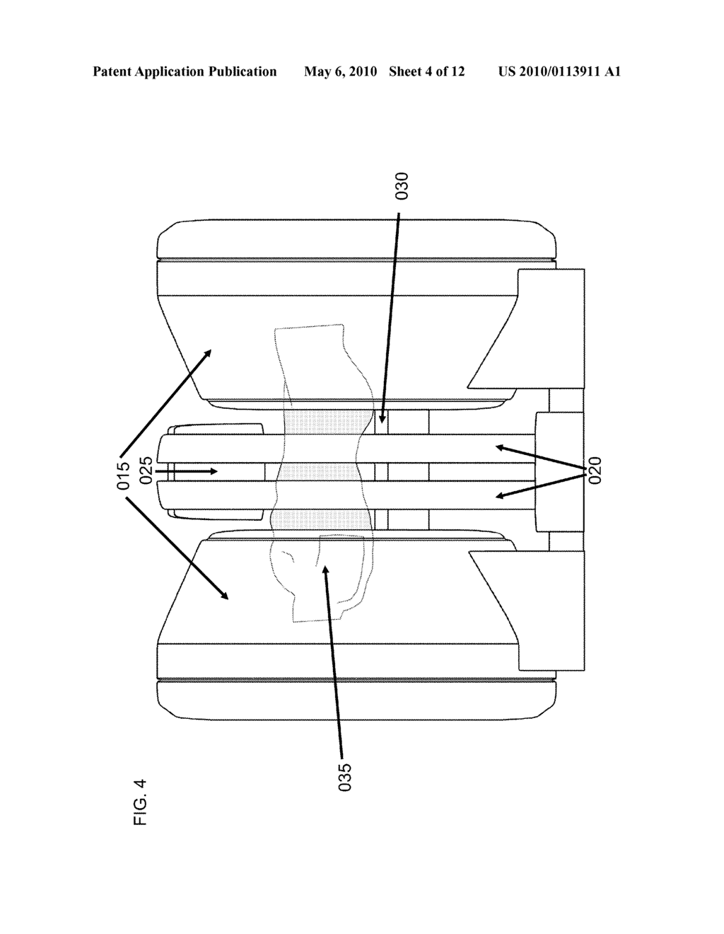 System for Delivering Conformal Radiation Therapy While Simultaneously Imaging Soft Tissue - diagram, schematic, and image 05