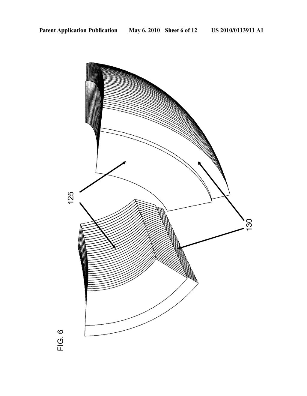 System for Delivering Conformal Radiation Therapy While Simultaneously Imaging Soft Tissue - diagram, schematic, and image 07