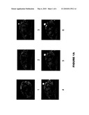 SMALL DIAMETER MRI MARKER AND RELATED METHOD diagram and image