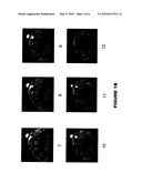 SMALL DIAMETER MRI MARKER AND RELATED METHOD diagram and image