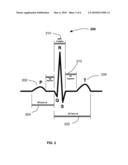 Seamlessly Embedded Heart Rate Monitor diagram and image