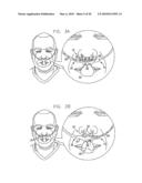 ORAL-NASAL CANNULA SYSTEM ENABLING CO2 AND BREATH FLOW MEASUREMENT diagram and image