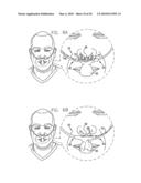 ORAL-NASAL CANNULA SYSTEM ENABLING CO2 AND BREATH FLOW MEASUREMENT diagram and image