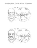 ORAL-NASAL CANNULA SYSTEM ENABLING CO2 AND BREATH FLOW MEASUREMENT diagram and image