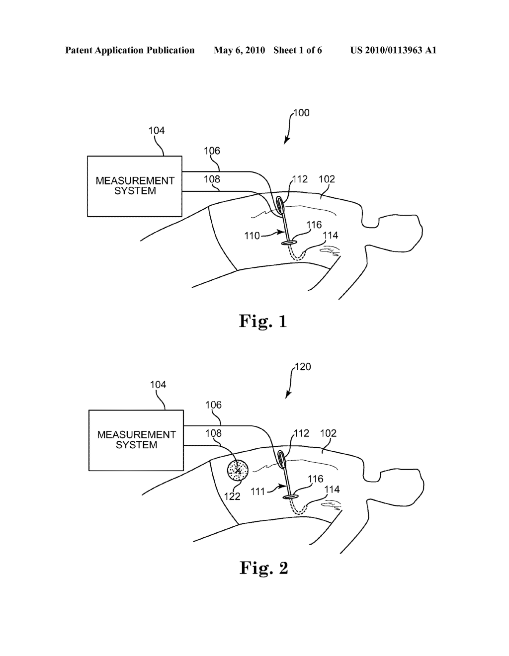 IMPEDANCE GUIDED TUNNELING TOOL - diagram, schematic, and image 02