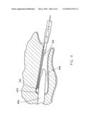 Method and apparatus for collection of biological samples diagram and image