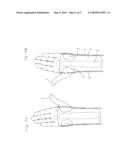 WRIST ORTHOSIS diagram and image