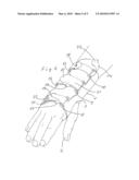 WRIST ORTHOSIS diagram and image