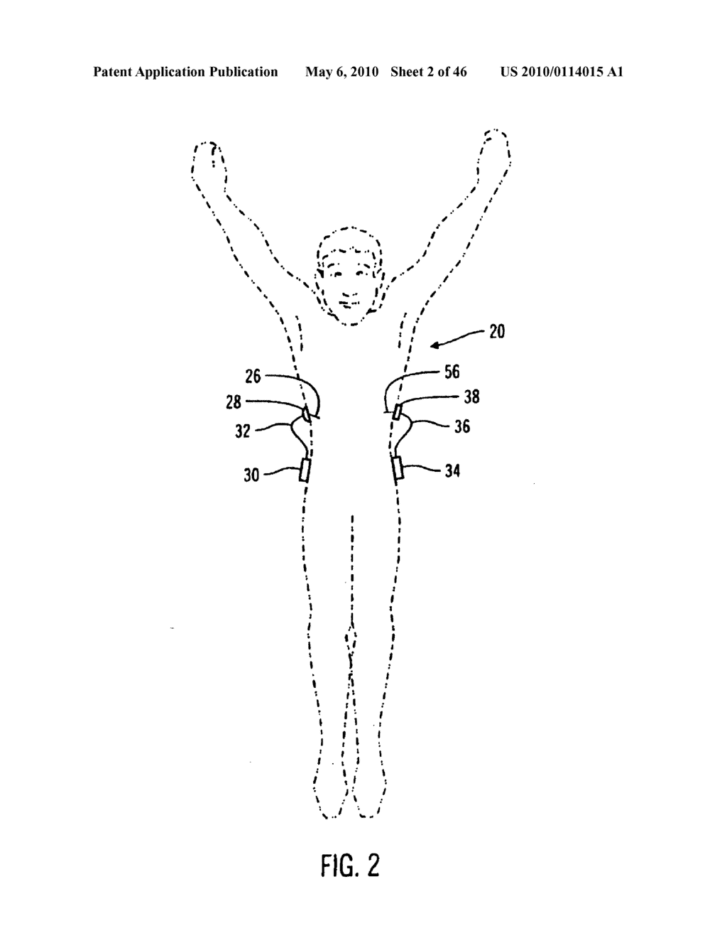 Apparatus and method for controlling insulin infusion with state variable feedback - diagram, schematic, and image 03