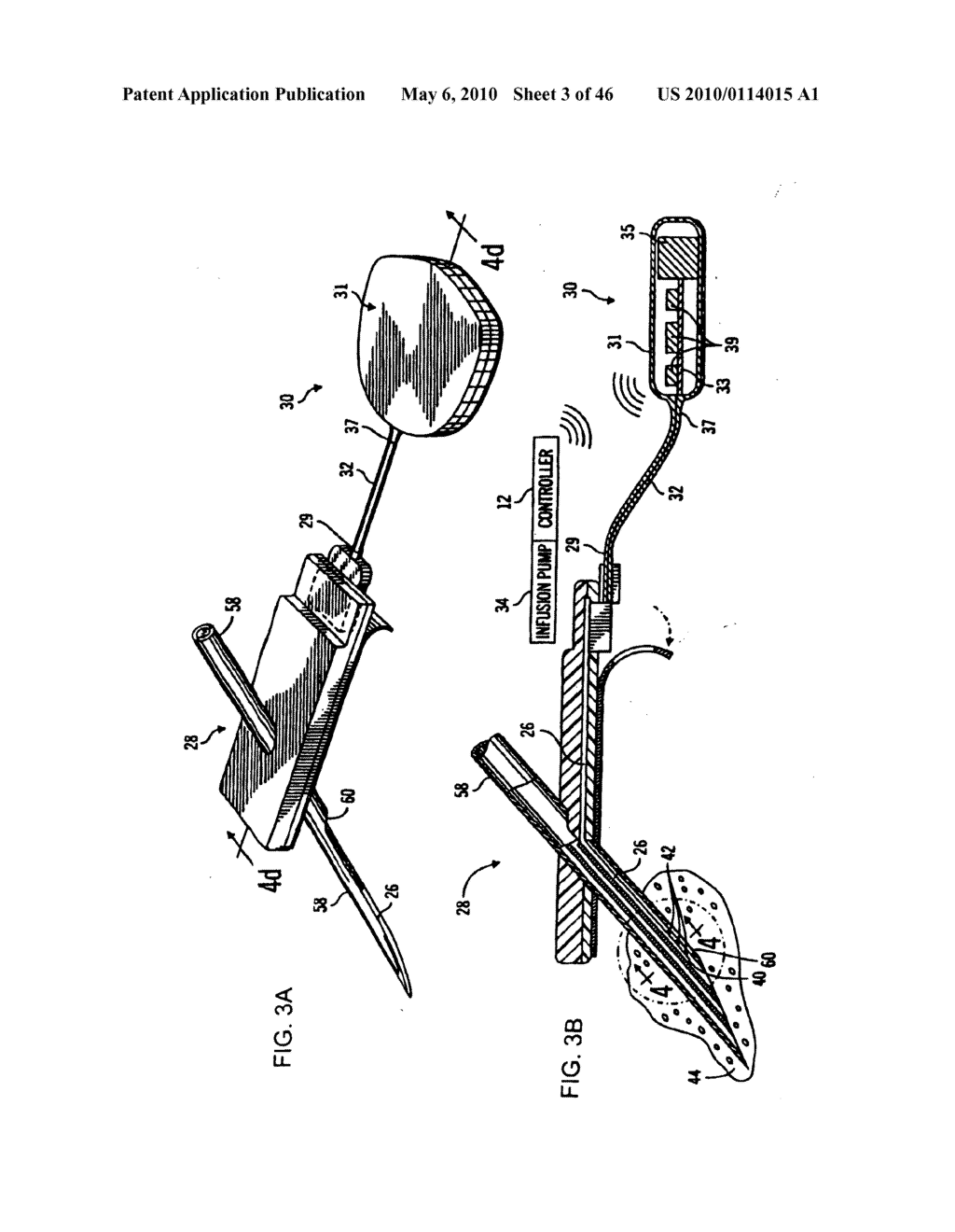 Apparatus and method for controlling insulin infusion with state variable feedback - diagram, schematic, and image 04