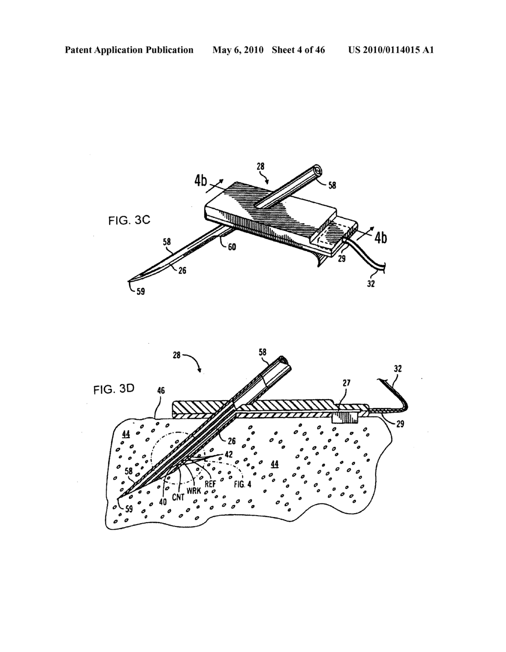 Apparatus and method for controlling insulin infusion with state variable feedback - diagram, schematic, and image 05