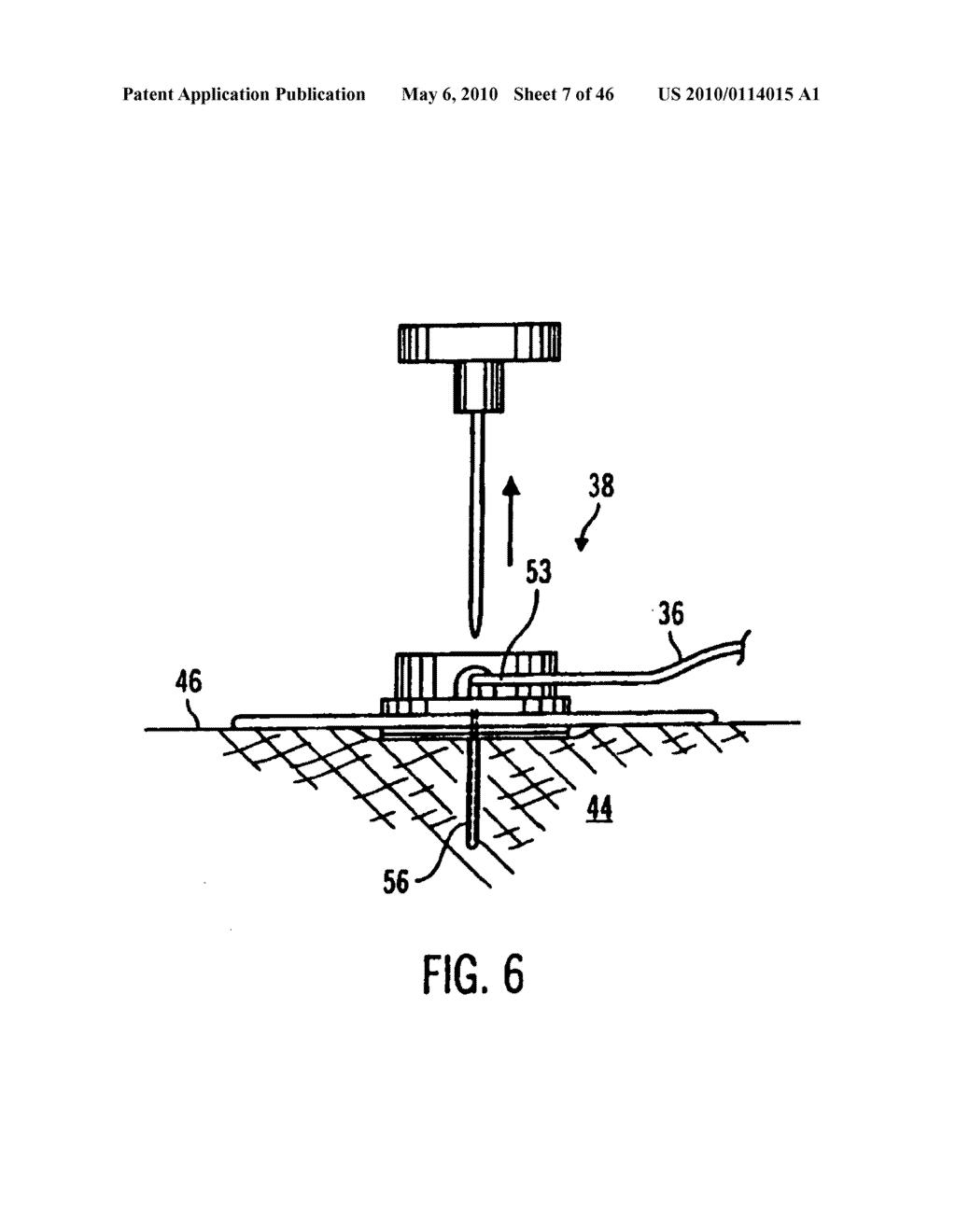 Apparatus and method for controlling insulin infusion with state variable feedback - diagram, schematic, and image 08