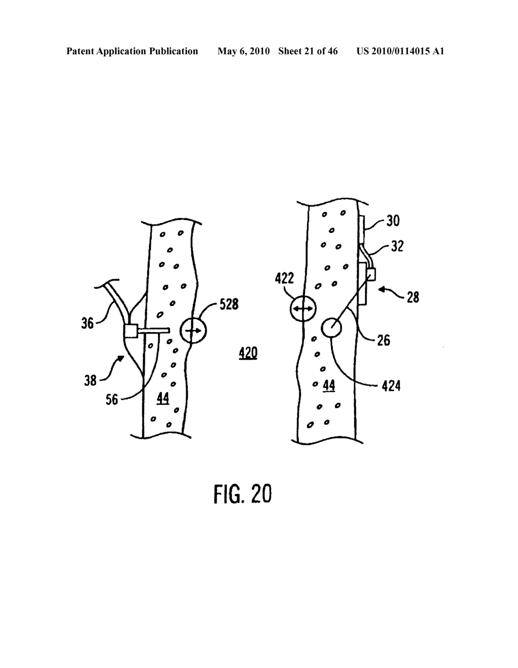 Apparatus and method for controlling insulin infusion with state variable feedback - diagram, schematic, and image 22