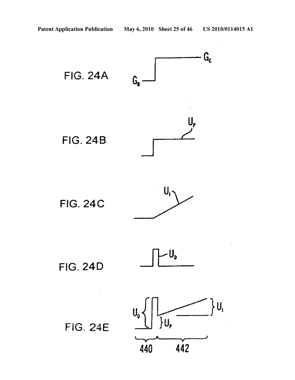 Apparatus and method for controlling insulin infusion with state variable feedback - diagram, schematic, and image 26