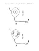 Apparatus and method for controlling insulin infusion with state variable feedback diagram and image