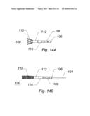 SYSTEMS AND METHODS FOR REMOVING OBSTRUCTIVE MATTER FROM BODY LUMENS AND TREATING VASCULAR DEFECTS diagram and image