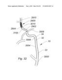 SYSTEMS AND METHODS FOR REMOVING OBSTRUCTIVE MATTER FROM BODY LUMENS AND TREATING VASCULAR DEFECTS diagram and image