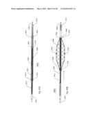 SYSTEMS AND METHODS FOR REMOVING OBSTRUCTIVE MATTER FROM BODY LUMENS AND TREATING VASCULAR DEFECTS diagram and image