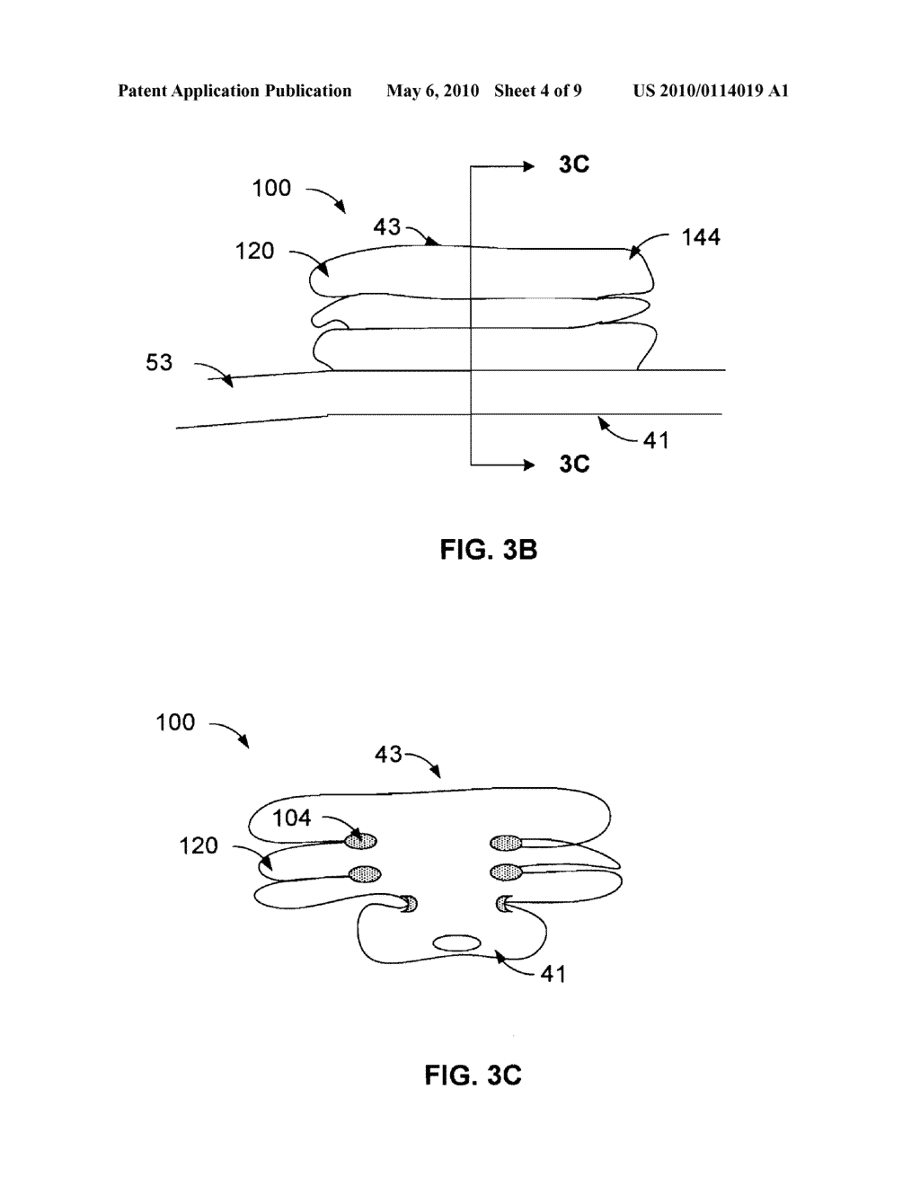 DEFLATABLE BIFURCATED DEVICE - diagram, schematic, and image 05