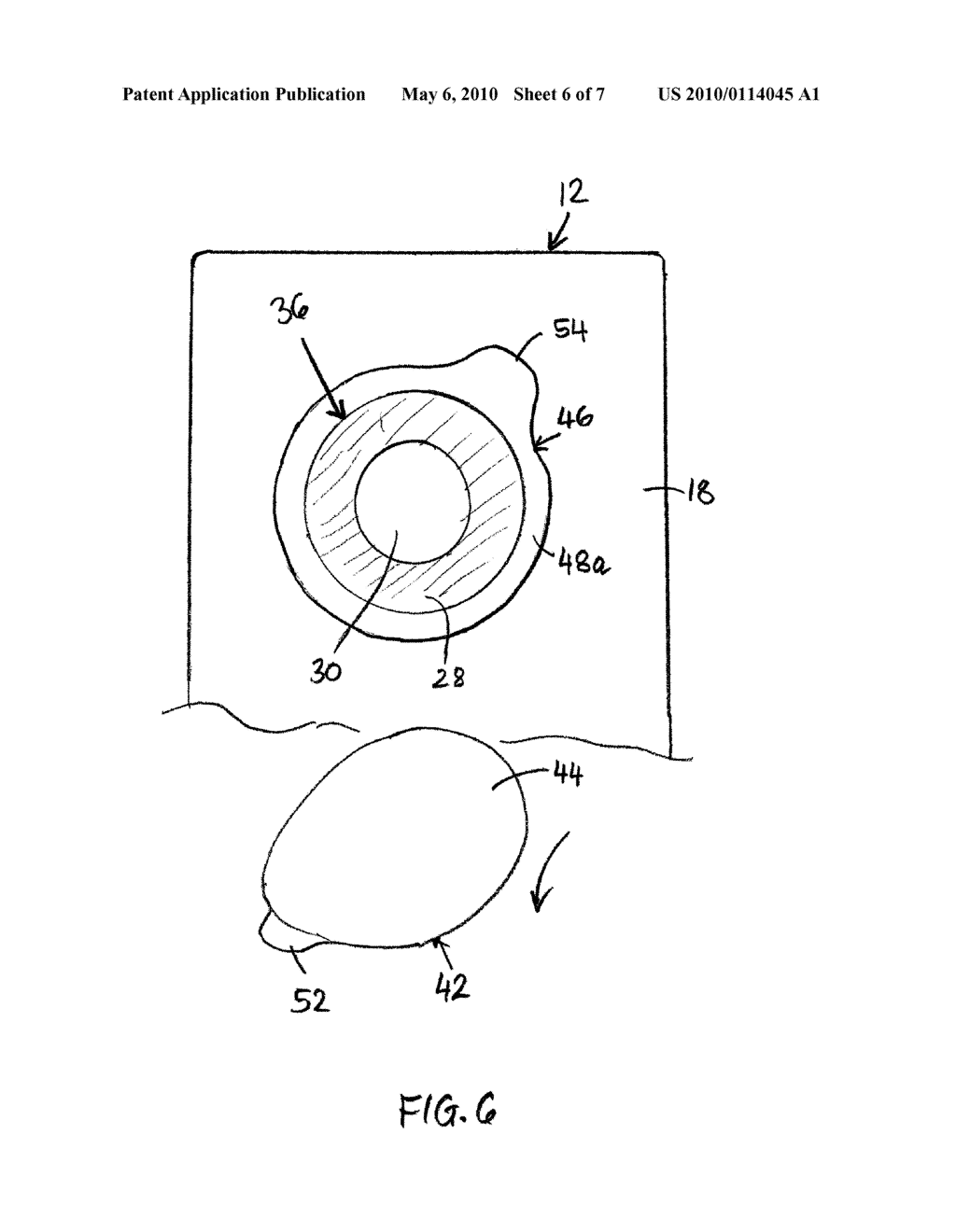 OSTOMY POUCH APPLIANE - diagram, schematic, and image 07