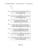 Methods, Systems, and Devices for Treating Intervertebral Discs Including Intradiscal Fluid Evacuation diagram and image