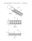 BIASING LASER CATHETER: MONORAIL DESIGN diagram and image