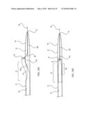 BIASING LASER CATHETER: MONORAIL DESIGN diagram and image