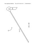 BIASING LASER CATHETER: MONORAIL DESIGN diagram and image