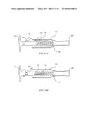 BIASING LASER CATHETER: MONORAIL DESIGN diagram and image