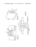 METHODS, DEVICES, AND SYSTEMS FOR NON-INVASIVE DELIVERY OF MICROWAVE THERAPY diagram and image