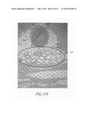 METHODS, DEVICES, AND SYSTEMS FOR NON-INVASIVE DELIVERY OF MICROWAVE THERAPY diagram and image