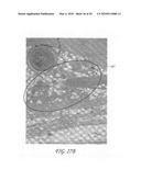 METHODS, DEVICES, AND SYSTEMS FOR NON-INVASIVE DELIVERY OF MICROWAVE THERAPY diagram and image