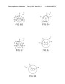 Epicardial Ablation Catheter and Method of Use diagram and image