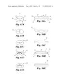 Intervertebral Disc Nucleus Implants and Methods diagram and image