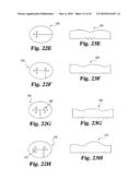 Intervertebral Disc Nucleus Implants and Methods diagram and image