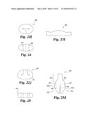 Intervertebral Disc Nucleus Implants and Methods diagram and image