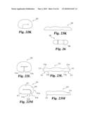 Intervertebral Disc Nucleus Implants and Methods diagram and image