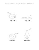 Intervertebral Disc Nucleus Implants and Methods diagram and image