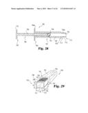 Intervertebral Disc Nucleus Implants and Methods diagram and image