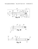 Intervertebral Disc Nucleus Implants and Methods diagram and image