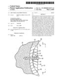 Soft Tissue Attachment Device diagram and image