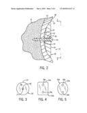 Soft Tissue Attachment Device diagram and image