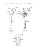 Soft Tissue Attachment Device diagram and image