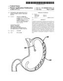 OPTIMIZING THE OPERATION OF AN INTRA-GASTRIC SATIETY CREATION DEVICE diagram and image