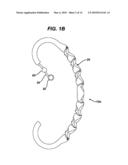 OPTIMIZING THE OPERATION OF AN INTRA-GASTRIC SATIETY CREATION DEVICE diagram and image