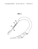 OPTIMIZING THE OPERATION OF AN INTRA-GASTRIC SATIETY CREATION DEVICE diagram and image